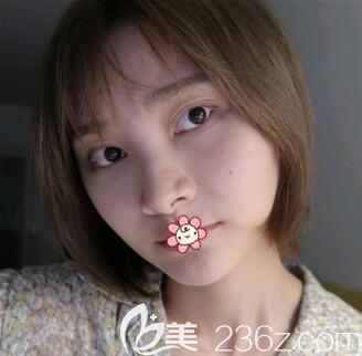 重庆时光整形做轮廓手术怎么样 重庆时光整形做轮廓手术怎么样