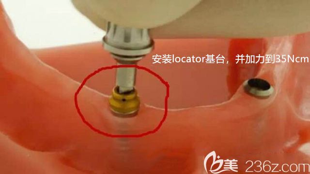安装上locator基台后图示 安装上locator基台后图示
