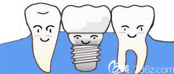 烤瓷牙种植牙的区别