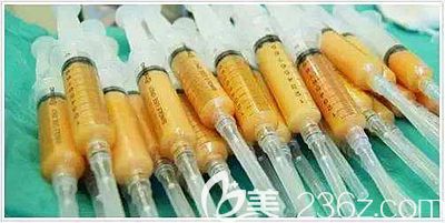 手臂吸脂量是因人而异的