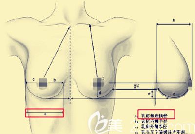 决定隆胸假体大小的标准
