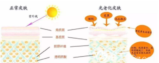 只是单纯的靠护肤品不去医院做定期的医美护理可以达到抗衰的<span style=