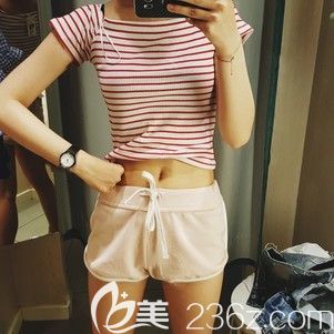 腰腹吸脂术后20天肚子还大，很可能是这几点医嘱护理你没做到位