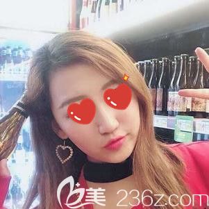 脂肪填充面部术后15天肿胀渐消 脂肪填充面部术后15天肿胀渐消