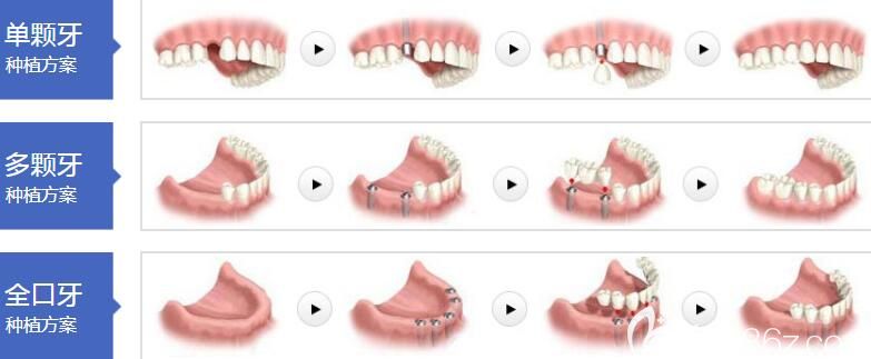 成都极光口腔林峰擅长项目 成都极光口腔林峰擅长项目