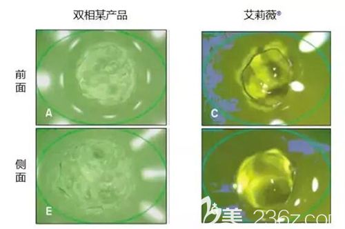 艾莉薇玻尿酸的优势 艾莉薇玻尿酸的优势