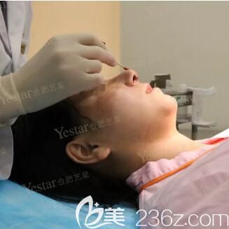 矫正手术后7天到院进行拆线 矫正手术后7天到院进行拆线