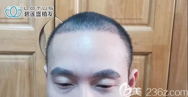 看到这些刚长出来的小毛茬，我就开心