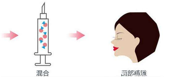 切记要想提高自体脂肪填充全脸后的成活率就不能热敷冷敷或者做剧烈的运动