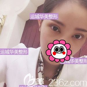 术后10天到院拆线眼睛轻微红肿