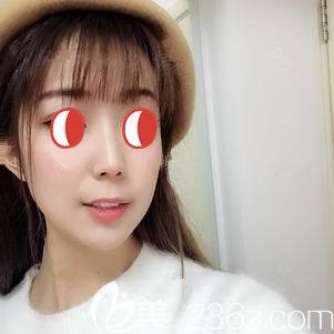 埋线提升术后25天没有出现红肿