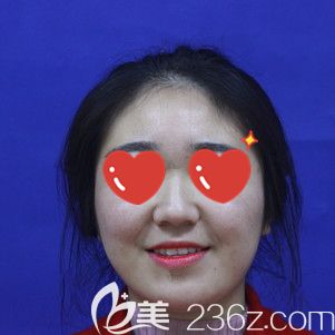 姑且算是婴儿肥的大脸盘子 姑且算是婴儿肥的大脸盘子