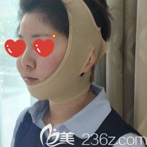 射频溶脂瘦脸术后即刻 射频溶脂瘦脸术后即刻