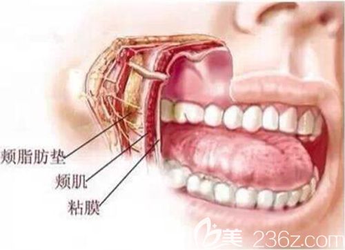 颊脂垫的位置 颊脂垫的位置