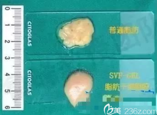 坏死和健康的脂肪细胞对比图