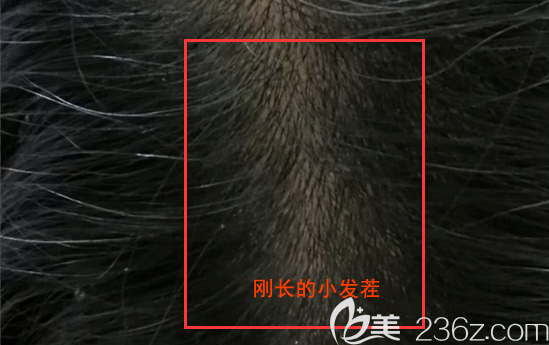 我精心呵护下长得小毛茬啊 我精心呵护下长得小毛茬啊