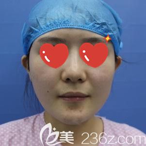 虽然是圆脸但显得整个人非常老气 虽然是圆脸但显得整个人非常老气