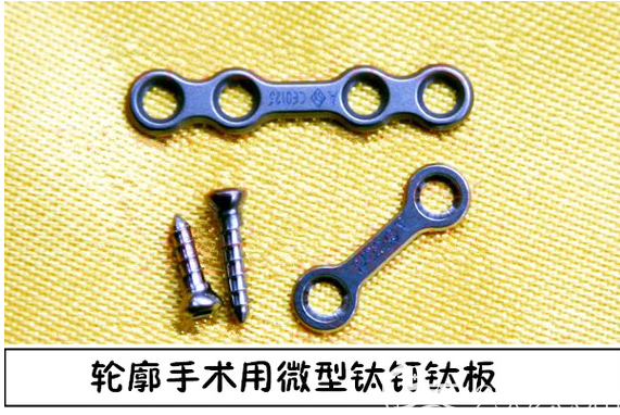 钛钉