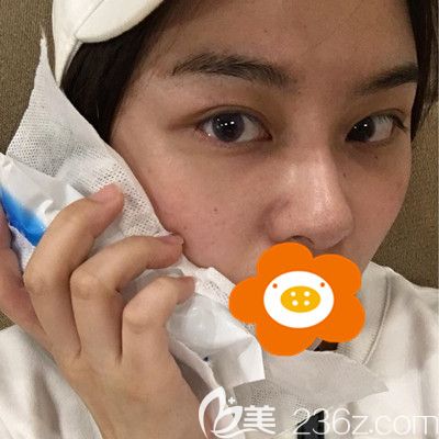 20200303_1583224725397784.jpg 术后冰敷_副本.jpg