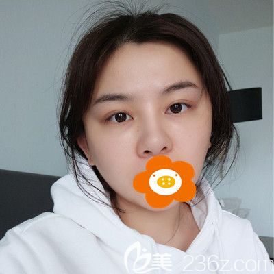 20200303_1583224733706680.jpg 术后5天_副本.jpg