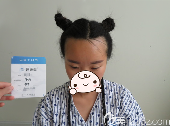 额头两边发际线高不但额头高还显脸还大 额头两边发际线高不但额头高还显脸还大