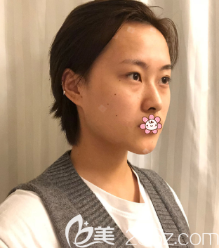 侧面的样子 侧面的样子