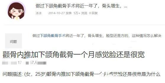 下颌骨截骨后脸还是很宽怎么办