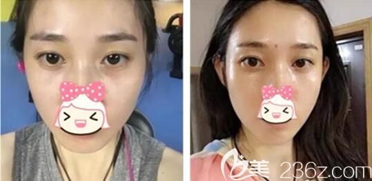 运动完出很多汗