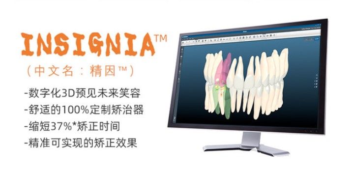 insignia牙套的个性化定制