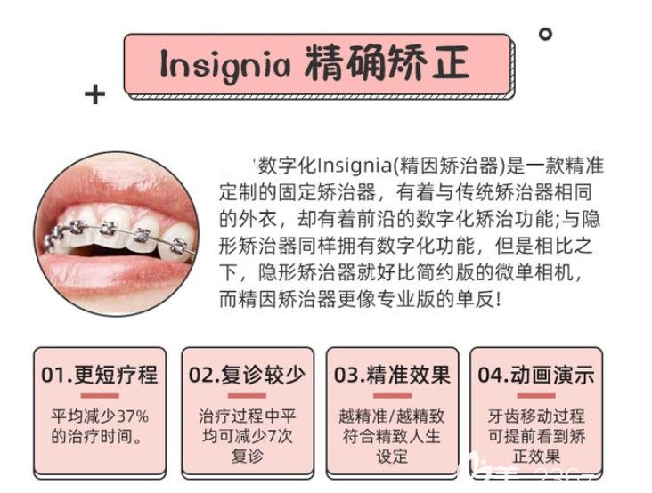  Insignia精准矫正的优缺点