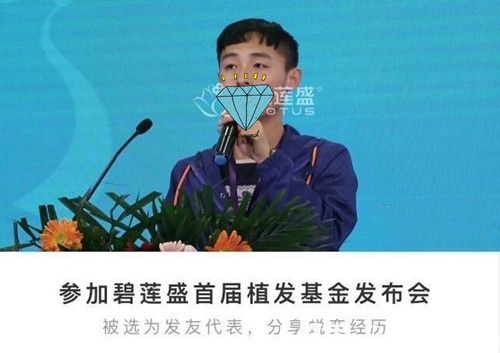 成功蜕变长出头发把经历分享给大家