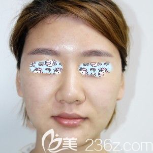 青春正年少皮肤却松弛 青春正年少皮肤却松弛