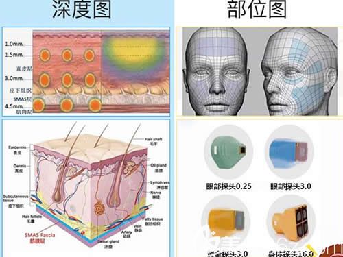 热玛吉工作原理 热玛吉工作原理