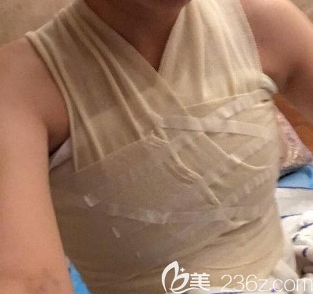 第二次隆胸比初次疼难道是因为修复手术需要重新剥离吗