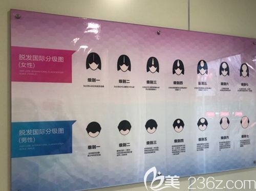 不同的脱发类型分级 不同的脱发类型分级