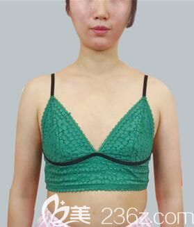 术前的我 术前的我