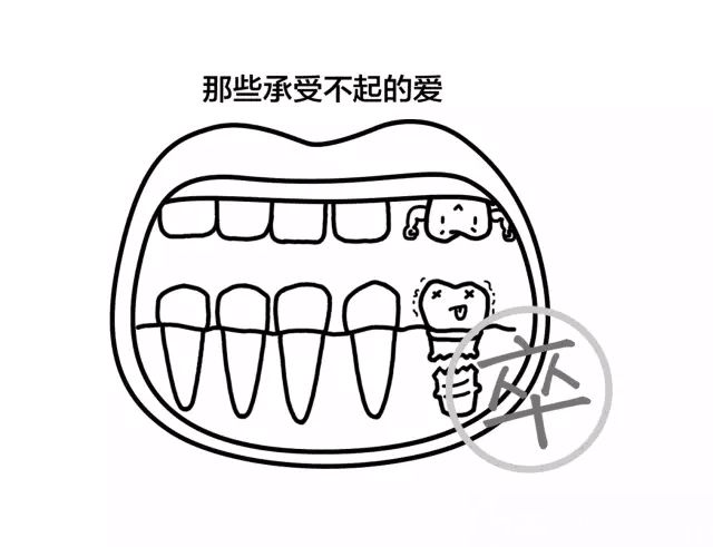 种植体机械性能