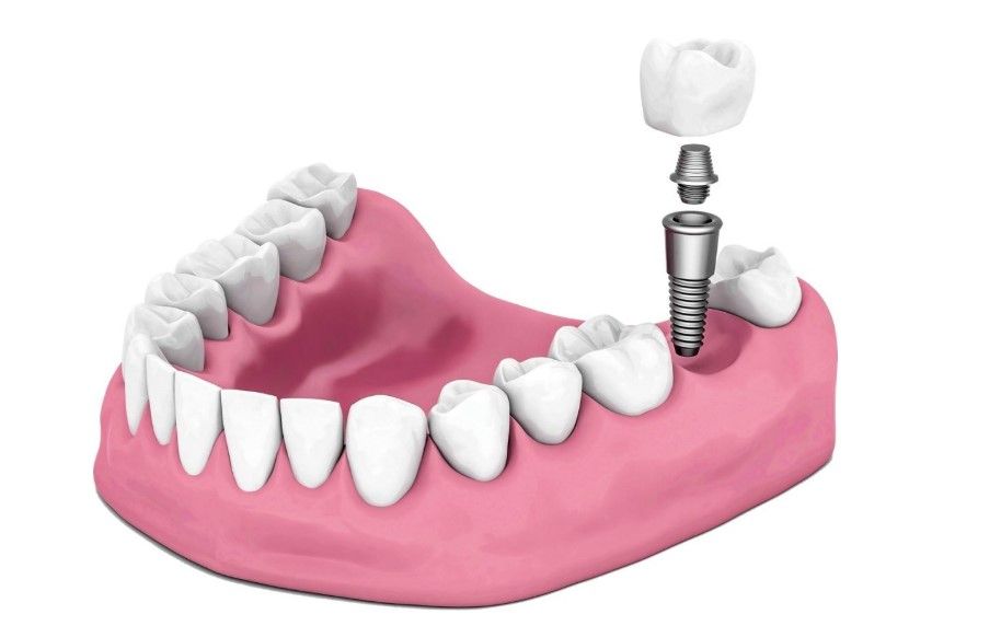 高医生比较擅长的项目 高医生比较擅长的项目