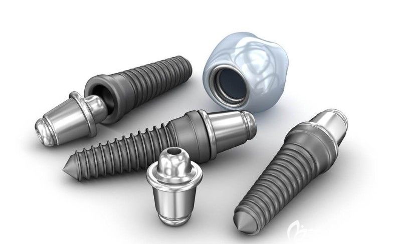 4d种植牙多少钱一颗 4d种植牙多少钱一颗