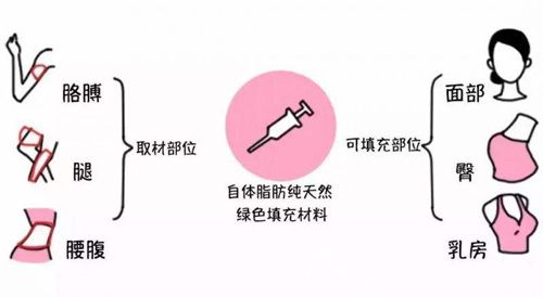 抽取脂肪时常见的部位 抽取脂肪时常见的部位
