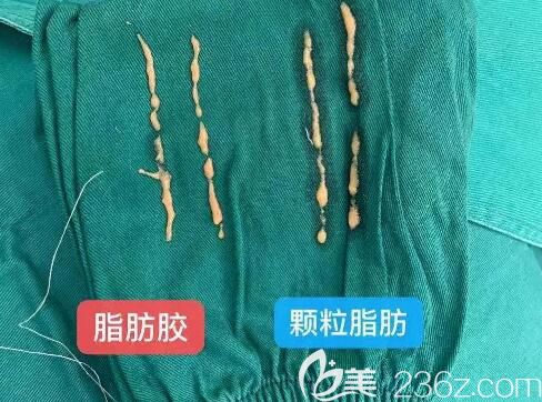 脂肪胶和脂肪的区别