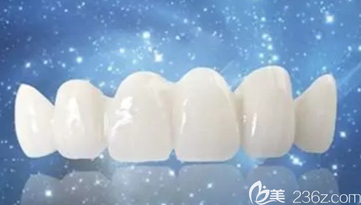 牙齿贴面和烤瓷牙的区别