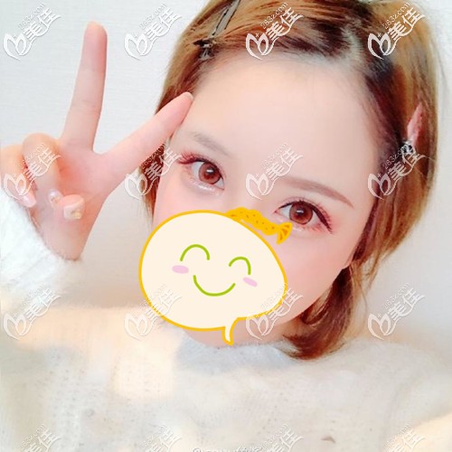 我方方的~大脑门 我方方的~大脑门