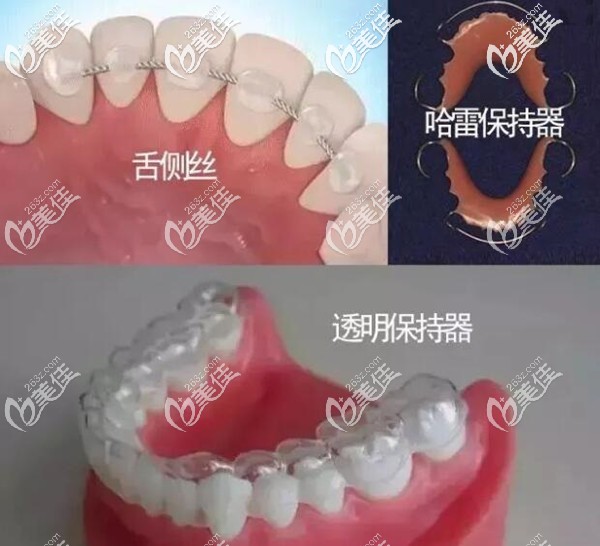 牙齿矫正后保持器要戴一辈子吗 牙齿矫正后保持器要戴一辈子吗