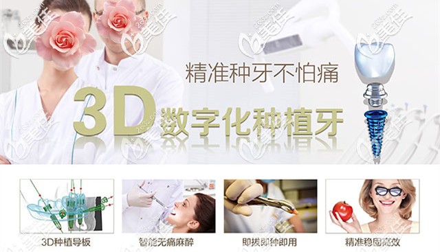 3D数字化种植牙 3D数字化种植牙