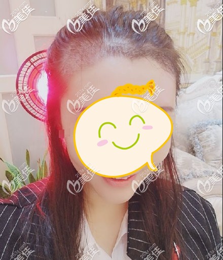 发际线种植一周效果图 发际线种植一周效果图