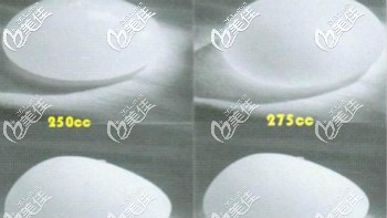 隆胸假体250和275cc大小对比