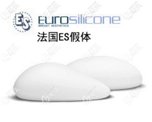 法国伊思雅隆胸假体优缺点