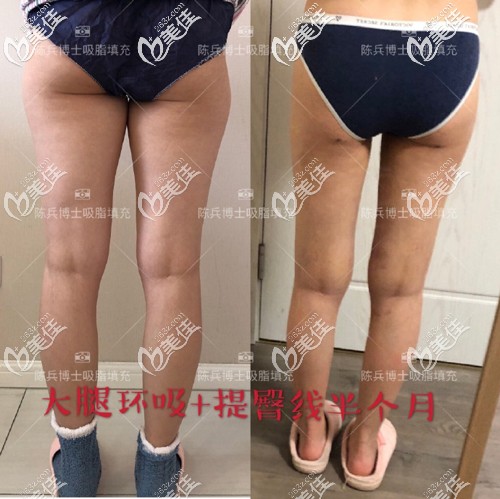 20200403_1585907252631737.jpg 881a7e6dgy1gdbxokbhy5j21hc1ha160.jpg