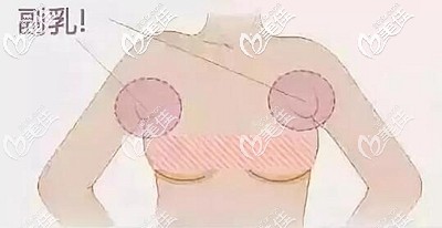 女性副乳出现的位置